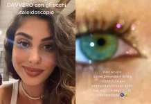 Occhi caleidoscopio, li hai anche tu?