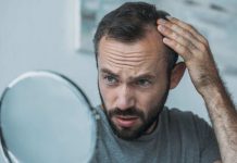 Tutta la verità sul trapianto di capelli