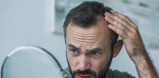 Tutta la verità sul trapianto di capelli
