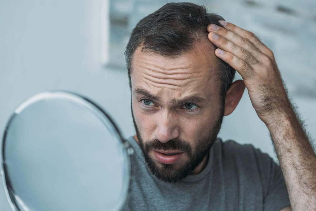 Tutta la verità sul trapianto di capelli