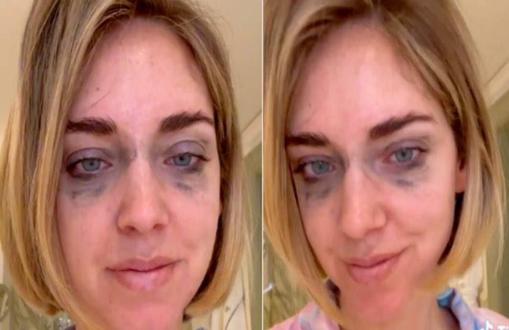 Chiara Ferragni, lo scatto assurdo