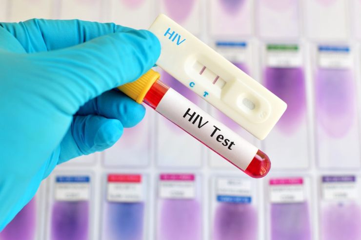 Qual è la piccola anti Hiv data gratis