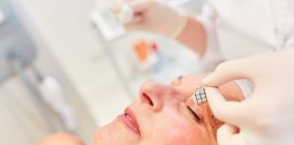 Eliminare la palpebra cadente senza chirurgia