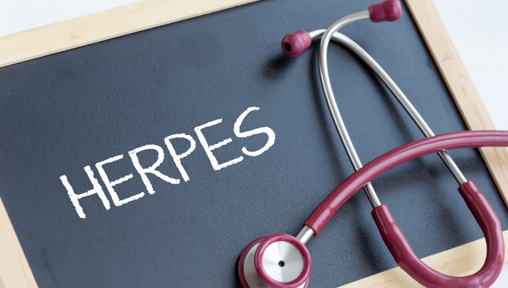 herpes chi è più soggetto