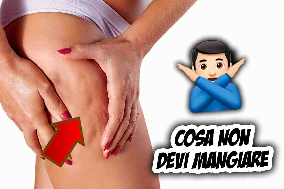 Cosa evitare di mangiare per combattere la cellulite