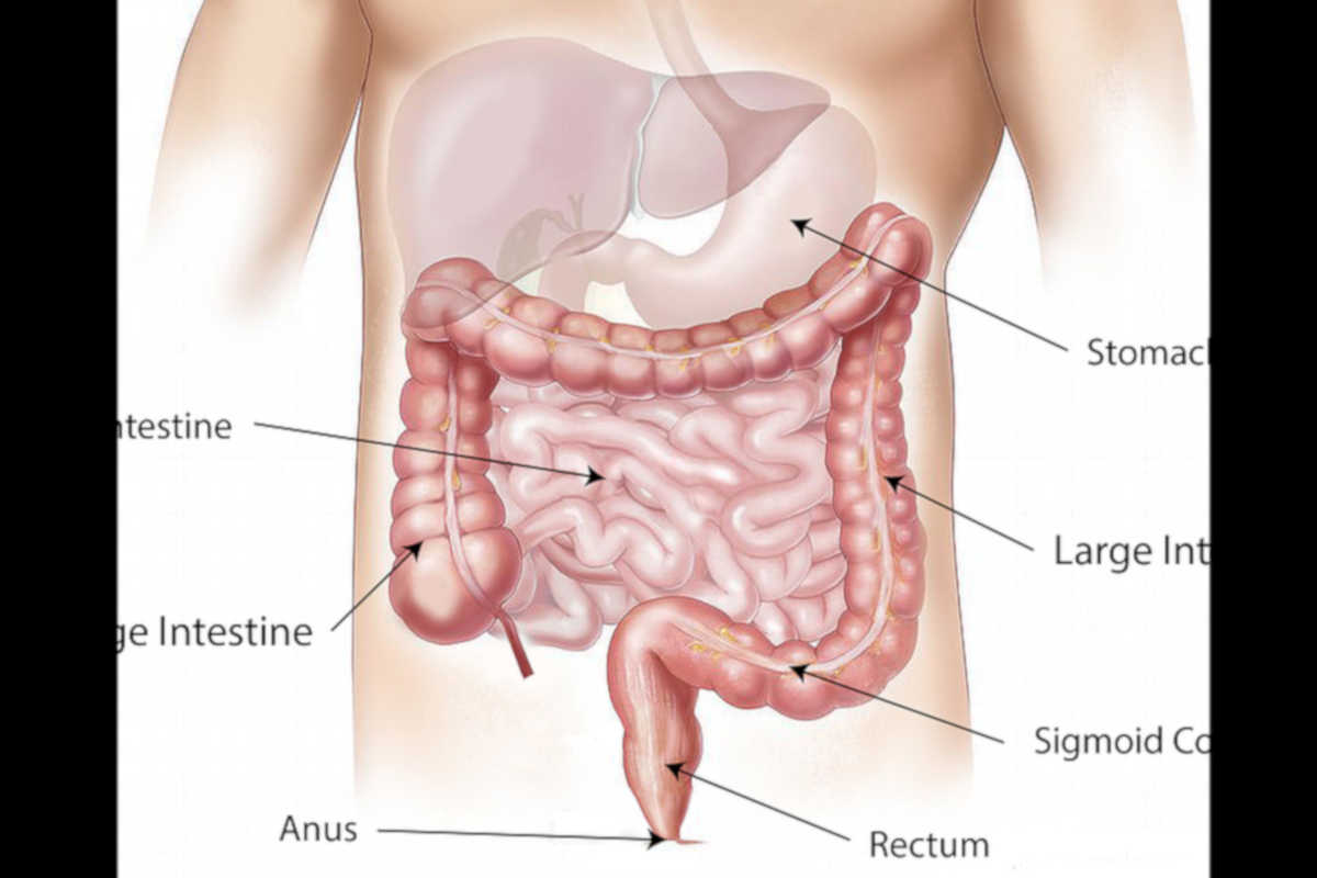 I sintomi del tumore colon-retto