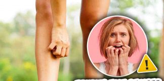 Prurito alle gambe e malattie