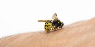 Puntura di api o vespe: cosa fare