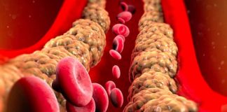 farmaco contro colesterolo