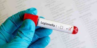 Allarme legionella, ecco cosa sapere
