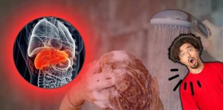 fegato problemi capelli diradati malattia