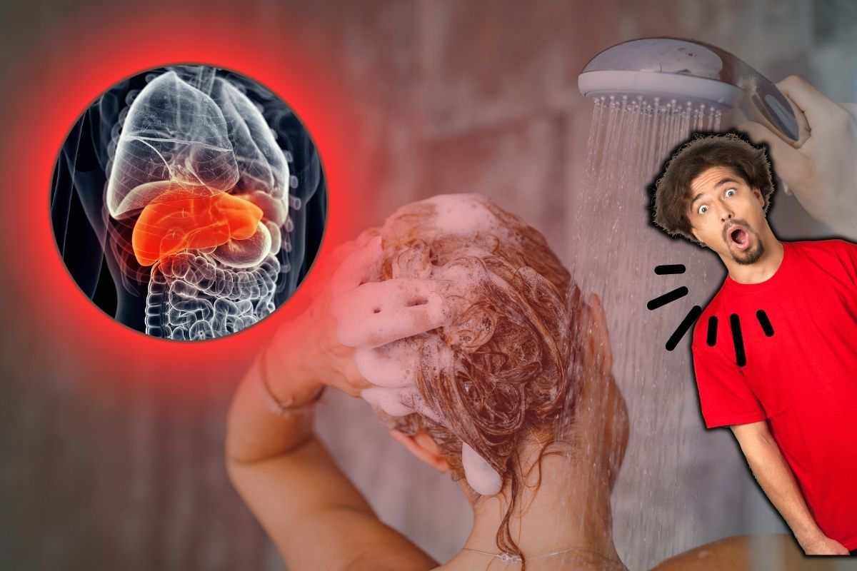 fegato problemi capelli diradati malattia